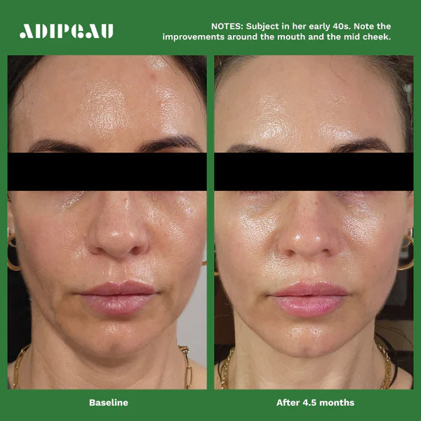 Volume Cream